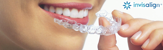 invisalign